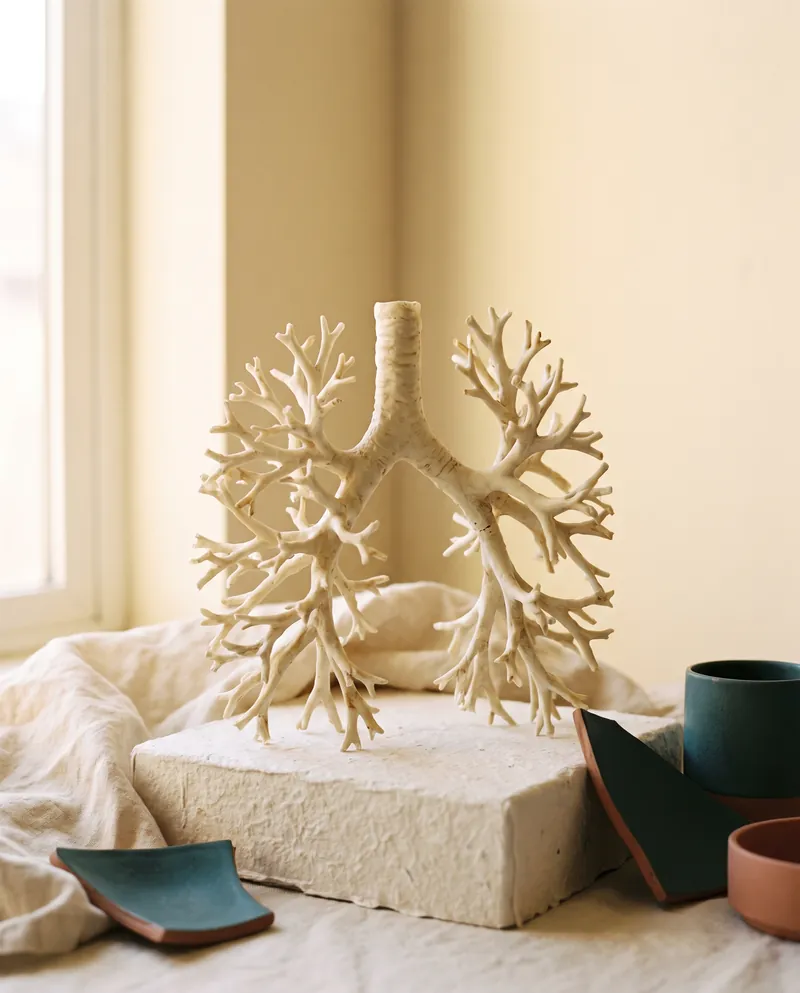 A resin cast of the bronchial tree on a paper plinth